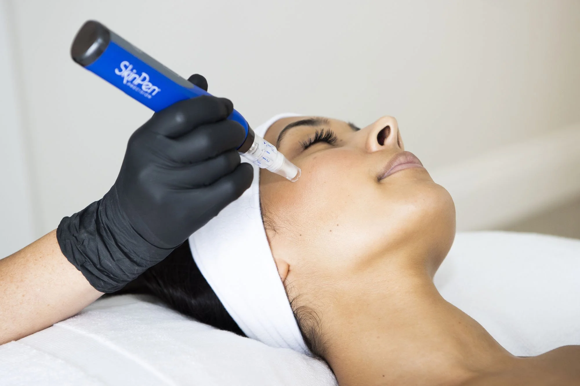 SkinPen Microneedling