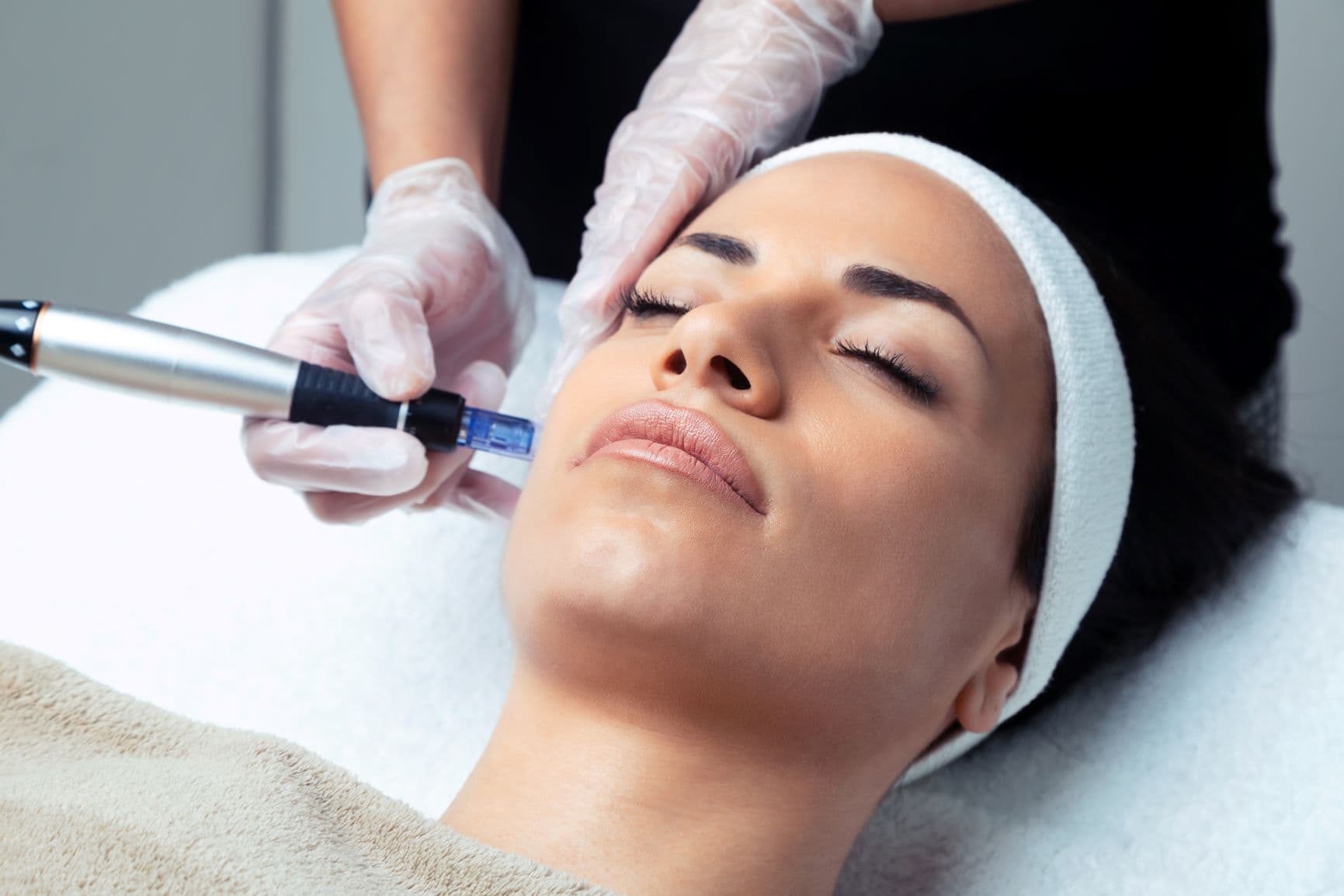 SkinPen Microneedling with VAMP