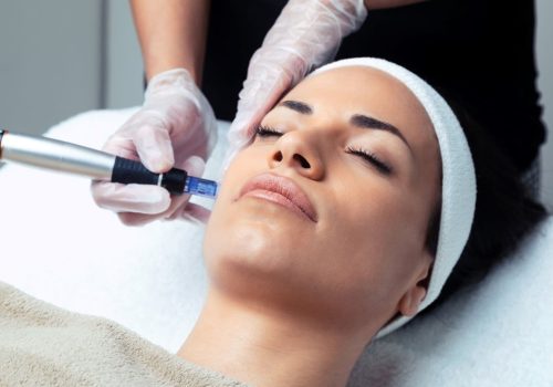 SkinPen Microneedling with VAMP