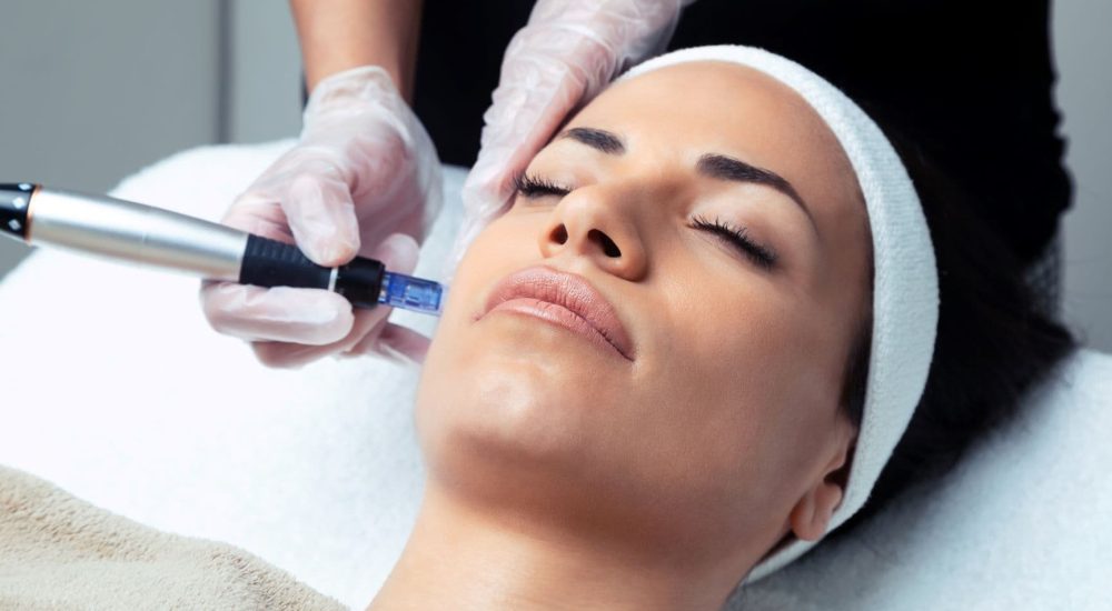 SkinPen Microneedling with VAMP